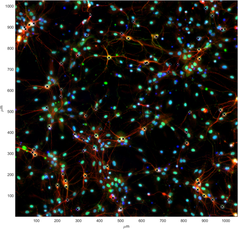 A macro shot of a micro world - a neuronal network